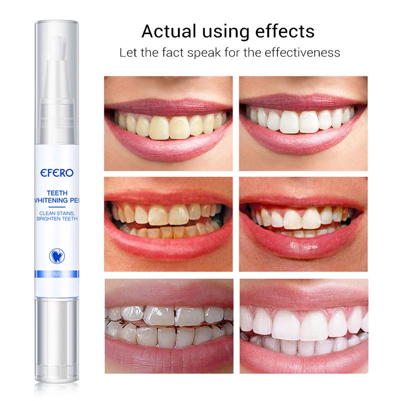 Stilou pentru Albirea Dintilor White Teeth, Efero, 5ml
