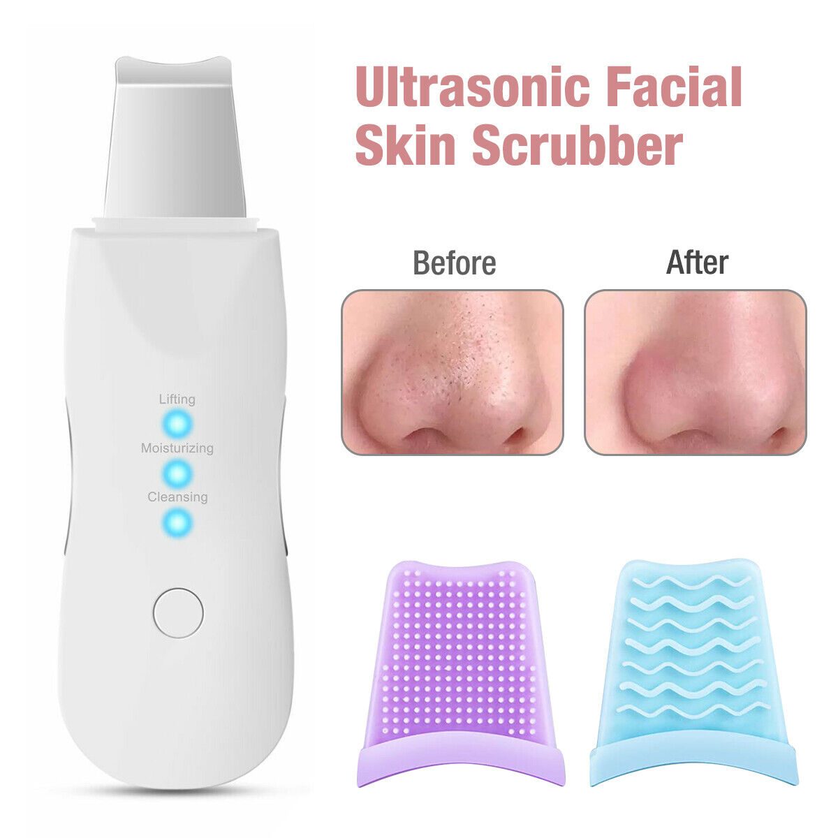Ultrasonic Skin Scrubber – Aparat de Curățare Facială Profundă și Îngrijire a Pielii