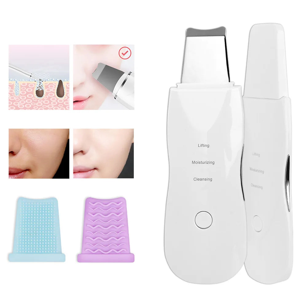 Ultrasonic Skin Scrubber – Aparat de Curățare Facială Profundă și Îngrijire a Pielii