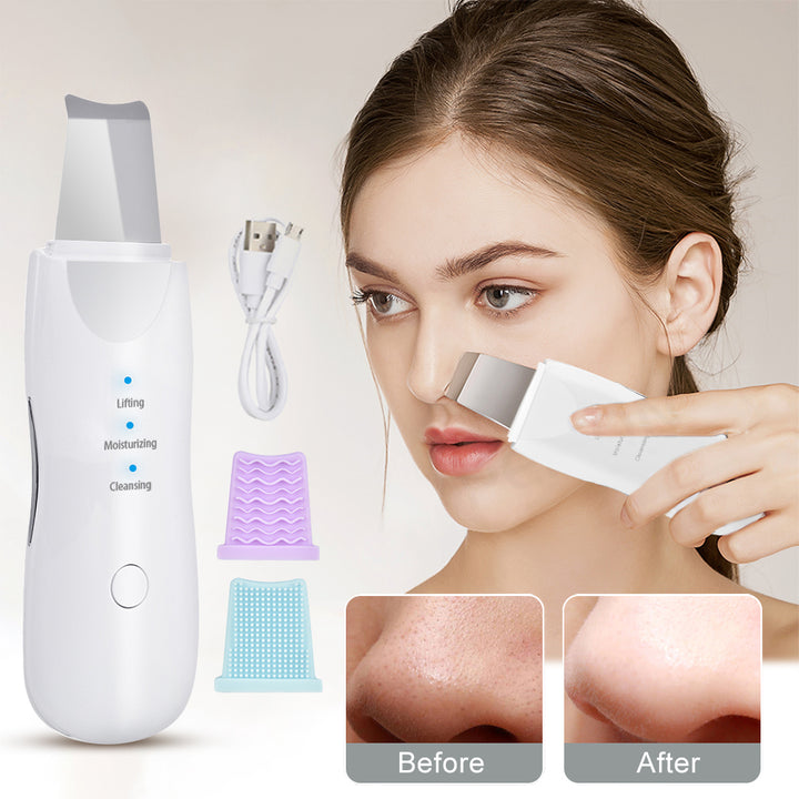 Ultrasonic Skin Scrubber – Aparat de Curățare Facială Profundă și Îngrijire a Pielii