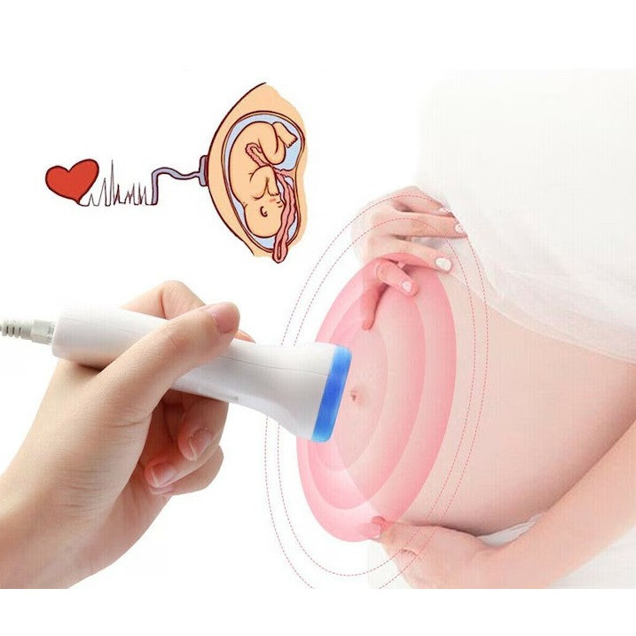 Monitor Fetal Doppler, Flippy, Monitorizare Sarcina, Ritm Cardiac, Ecran LCD 4.5 cm, 2 x Baterii AA (neincluse), Portabil, din ABS, 12.8 x 9.6 x 3 cm, Utilizare de la 9 Saptamani, Albastru-2