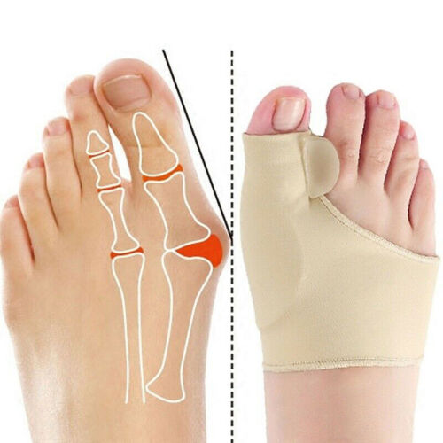 Set 2 bucăți Separator Deget Mare din Material Elastic, Orteza Ortopedică pentru Hallux Valgus cu Gel