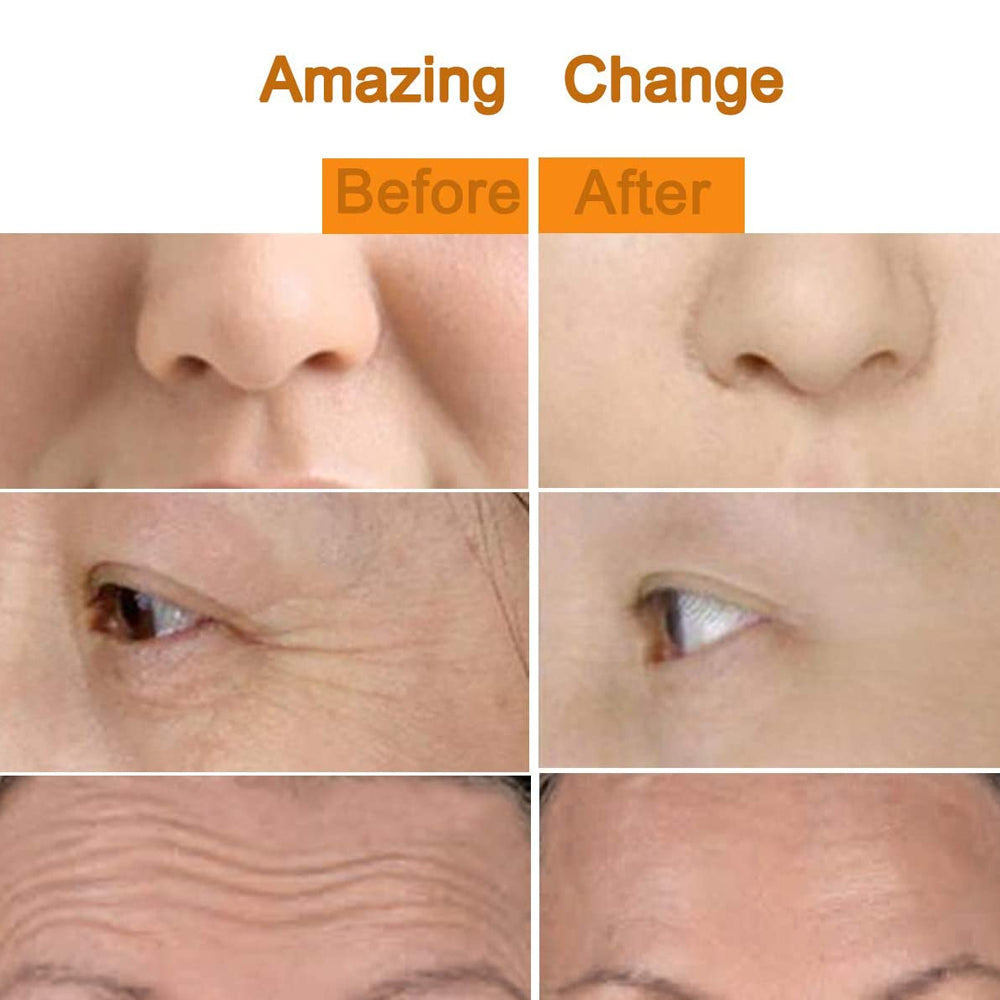 Rola Masaj Facial, Bile 3D, cu Vibratii si Rotire, 15 cm, culoare auriu.
