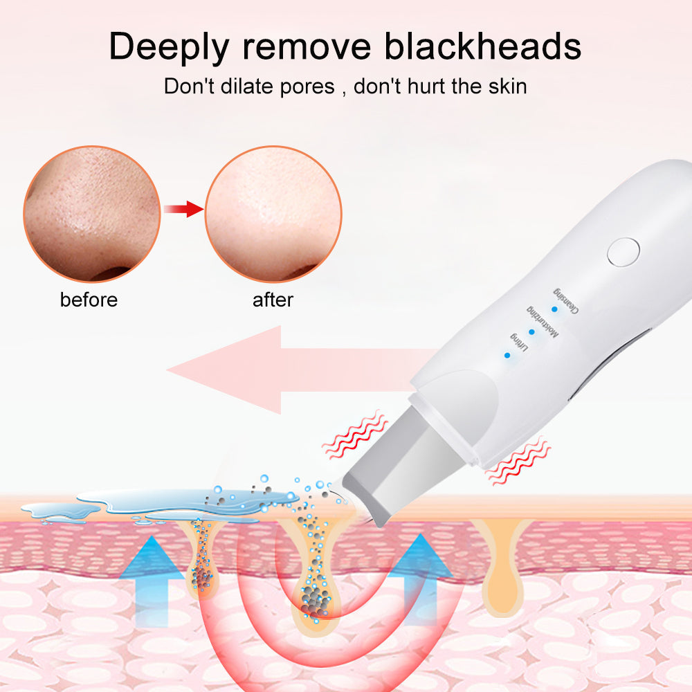 Ultrasonic Skin Scrubber – Aparat de Curățare Facială Profundă și Îngrijire a Pielii