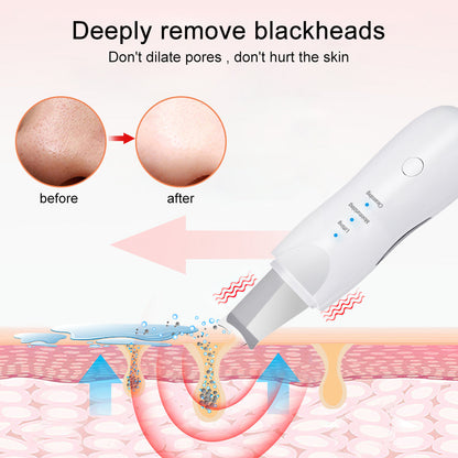 Ultrasonic Skin Scrubber – Aparat de Curățare Facială Profundă și Îngrijire a Pielii