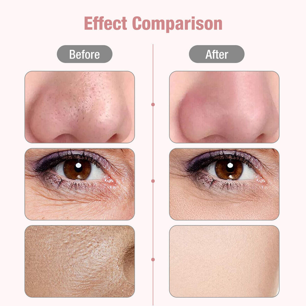 Ultrasonic Skin Scrubber – Aparat de Curățare Facială Profundă și Îngrijire a Pielii